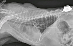 x-ray chylothorax