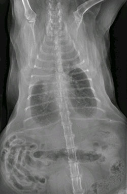 x-ray chylothorax