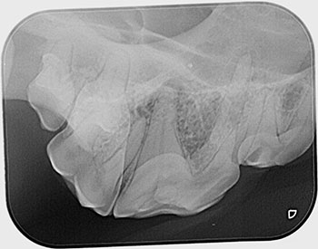 [X-ray of canine tooth with fracture]