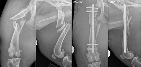 [radiographs before and after fracture repair]