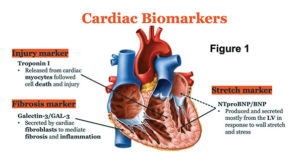 Cardiac Biomarker Diagram