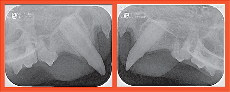 radiographs of maxillary canine teeth showing one with long-standing endodontic disease